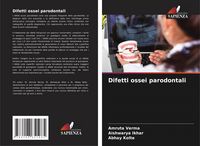 Produktbild: Difetti ossei parodontali