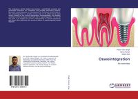 Produktbild: Osseointegration