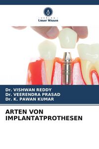 Produktbild: ARTEN VON IMPLANTATPROTHESEN