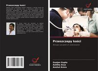 Produktbild: Przeszczepy ko&iquest;ci