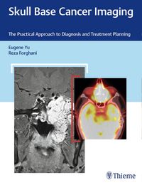 Produktbild: Skull Base Cancer Imaging