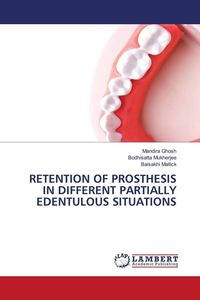 Produktbild: RETENTION OF PROSTHESIS IN DIFFERENT PARTIALLY EDENTULOUS SITUATIONS