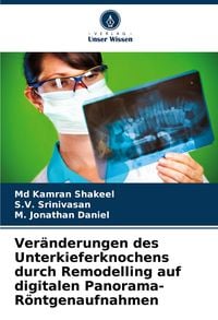 Produktbild: Ver&auml;nderungen des Unterkieferknochens durch Remodelling auf digitalen Panorama-R&ouml;ntgenaufnahmen