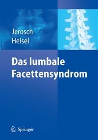 Produktbild: Das lumbale Facettensyndrom