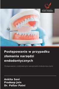 Produktbild: Post&iquest;powanie w przypadku z&iquest;amania narz&iquest;dzi endodontycznych