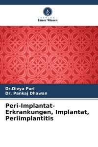 Produktbild: Peri-Implantat-Erkrankungen, Implantat, Periimplantitis