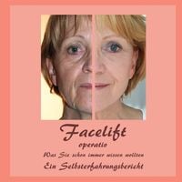 Produktbild: Facelift operativ