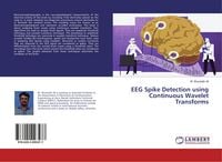 Produktbild: EEG Spike Detection using Continuous Wavelet Transforms