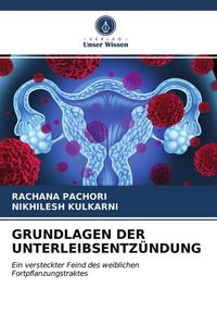 Produktbild: Grundlagen der Unterleibsentz&uuml;ndung