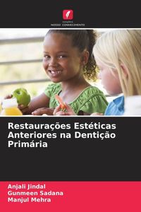 Produktbild: Restaura&ccedil;&otilde;es Est&eacute;ticas Anteriores na Denti&ccedil;&atilde;o Prim&aacute;ria