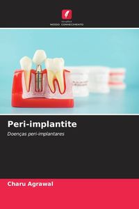 Produktbild: Peri-implantite