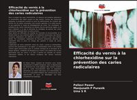 Produktbild: Efficacit&eacute; du vernis &agrave; la chlorhexidine sur la pr&eacute;vention des caries radiculaires