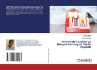 Produktbild: Immediate Loading V/s Delayed Loading of Dental Implants