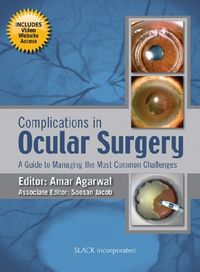 Produktbild: Agarwal, A:  Complications in Ocular Surgery