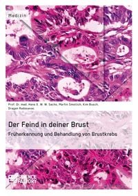 Produktbild: Der Feind in deiner Brust. Fr&uuml;herkennung und Behandlung von Brustkrebs