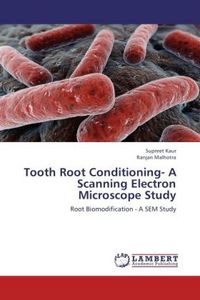 Produktbild: Kaur, S: Tooth Root Conditioning- A Scanning Electron Micros