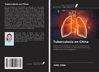 Produktbild: Tuberculosis en China