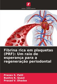Produktbild: Fibrina rica em plaquetas (PRF): Um raio de esperan&ccedil;a para a regenera&ccedil;&atilde;o periodontal