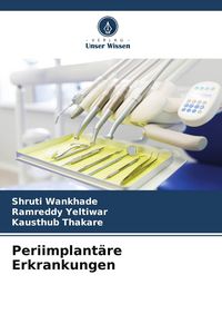 Produktbild: Periimplant&auml;re Erkrankungen