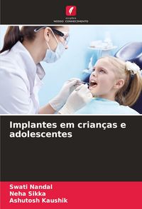 Produktbild: Implantes em crian&ccedil;as e adolescentes