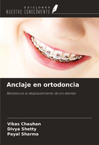 Produktbild: Anclaje en ortodoncia