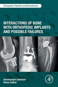 Produktbild: Interactions of Bone with Orthopedic Implants and Possible Failures