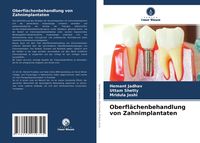 Produktbild: Oberfl&auml;chenbehandlung von Zahnimplantaten