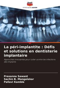 Produktbild: La p&eacute;ri-implantite : D&eacute;fis et solutions en dentisterie implantaire