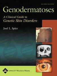 Produktbild: Genodermatoses 2/e