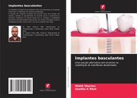 Produktbild: Implantes basculantes