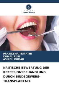 Produktbild: Kritische Bewertung der Rezessionsbehandlung Durch Bindegewebs-Transplantate
