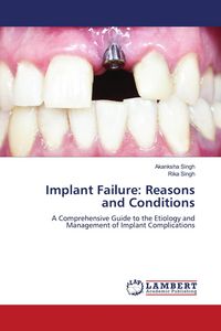 Produktbild: Implant Failure: Reasons and Conditions