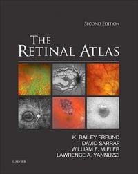 Produktbild: The Retinal Atlas E-Book