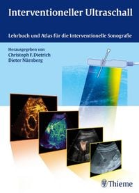 Produktbild: Interventioneller Ultraschall