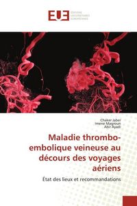 Produktbild: Maladie thrombo-embolique veineuse au d&eacute;cours des voyages a&eacute;riens