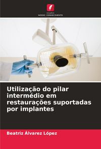 Produktbild: Utiliza&ccedil;&atilde;o do pilar interm&eacute;dio em restaura&ccedil;&otilde;es suportadas por implantes