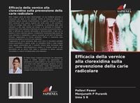 Produktbild: Efficacia della vernice alla clorexidina sulla prevenzione della carie radicolare