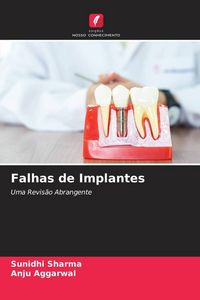 Produktbild: Sharma, S: Falhas de Implantes