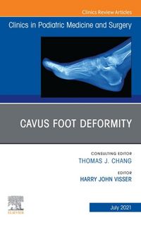 Produktbild: Cavus Foot Deformity, An Issue of Clinics in Podiatric Medicine and Surgery, E-Book