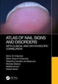 Produktbild: Iorizzo, M: Atlas of Nail Signs and Disorders with Clinical