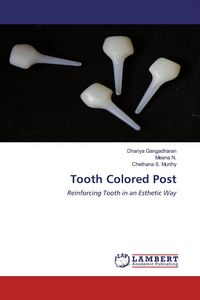 Produktbild: Tooth Colored Post