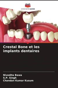 Produktbild: Crestal Bone et les implants dentaires