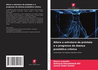 Produktbild: Altera a estrutura da pr&oacute;stata e o progresso da doen&ccedil;a prost&aacute;tica cr&ocirc;nica