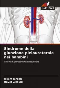 Produktbild: Sindrome della giunzione pieloureterale nei bambini