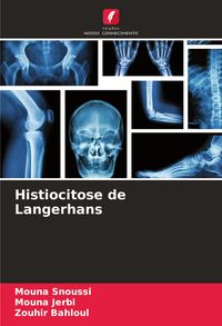 Produktbild: Histiocitose de Langerhans