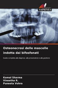 Produktbild: Osteonecrosi delle mascelle indotta dai bifosfonati