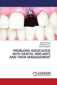 Produktbild: Problems Associated with Dental Implants and Their Management
