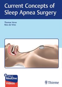 Produktbild: Current Concepts of Sleep Apnea Surgery