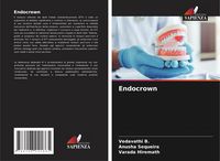 Produktbild: Endocrown