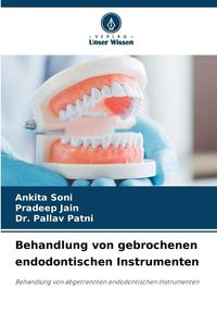 Produktbild: Behandlung von gebrochenen endodontischen Instrumenten